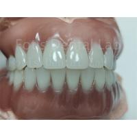 China Comfortable Full Upper Acrylic Denture Complete Acrylic Denture With Ivoclar Teeth factory