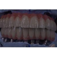 China Advanced Clinic Dental Implant Crowns For Superior Functionality factory
