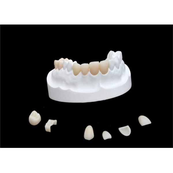 Quality Inlays Onlays Ceramic Dental Crown Strong Veneer For Dental Department for sale
