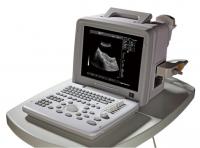 China 12 Inch Notebook Portable Ultrasound Scanner With Window 10 system(PC) factory