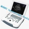 China 2D pORTABLE Ultrasound Scanner with High Quality factory