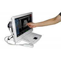 China SGU8 18 inch B/W ultrasound scanner,PC based Ultrasound machine with 3.5MHz probe factory