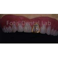China OEM Natural Full Acrylic Denture Ivoclar Teeth Stain Resistance factory