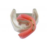 Quality High Biological Inter Miscibility Denture Dental Lab Safety Implant for sale