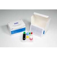 Quality Human Igm Elisa Test EDTA Plasma Antibody Elisa Kit ISO13485 for sale