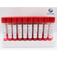 china 5ml Blood Specimen Tubes