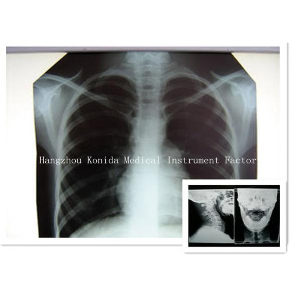 Quality Digital Medical X Ray Dry Film 14 x 17inch Health Imaging Radiographic Film for sale