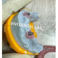 Quality Ivoclar Implant Ball Attachments Removable Dental Implant Material For Oral for sale