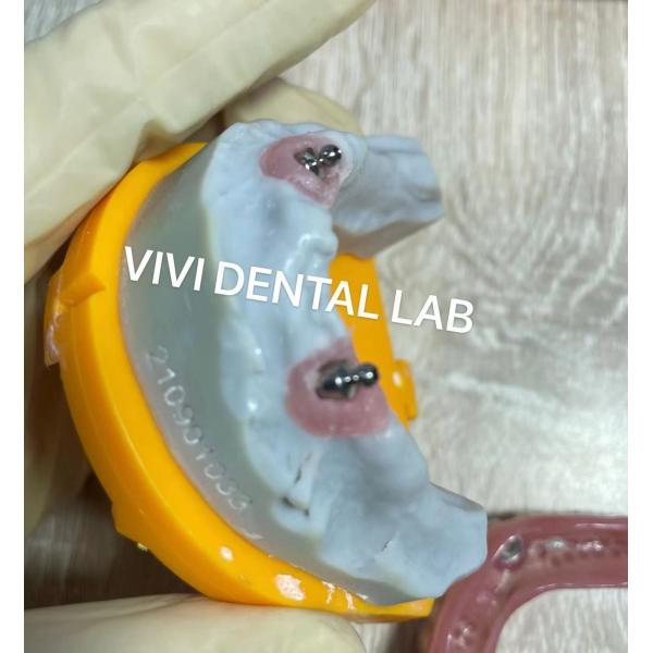 Quality Ivoclar Implant Ball Attachments Removable Dental Implant Material For Oral Hygiene for sale