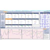 China PC Based ECG Holter Monitoring System 24 Hours Ambulatory Recording iTengo factory
