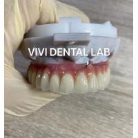 China Scheftner Ivoclar Porcelain Fused Metal Crowns Dental SLM Technique factory