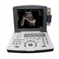 Quality Portable Full Digital Diagnostic Ultrasound scanner OEM for sale