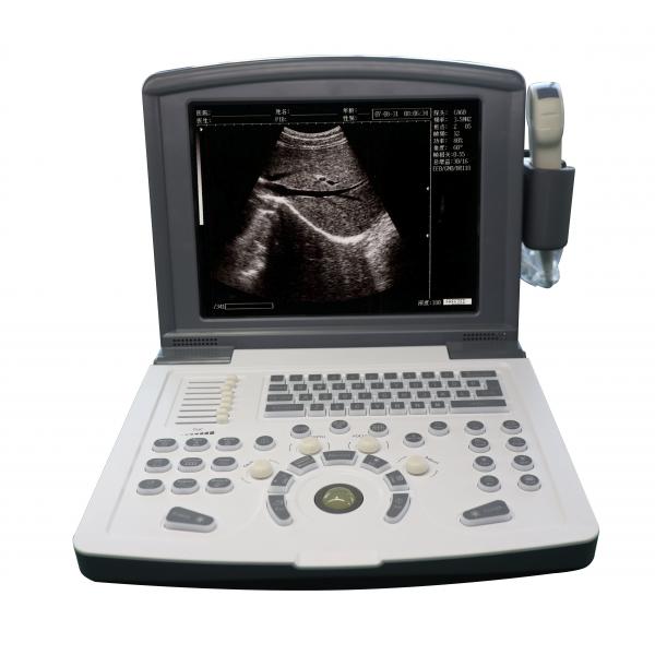 Quality Portable Full Digital Diagnostic Ultrasound scanner OEM for sale