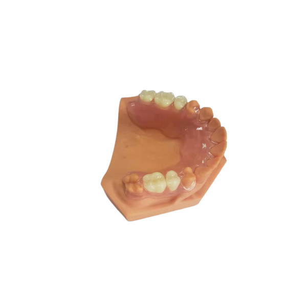 Quality 3D Printed Dentures For Dental Labs Based On Digital Data for sale