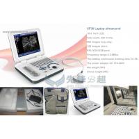 China Medical Home Pregnancy Ultrasound Machine DRF RDA Imaging USB Port factory