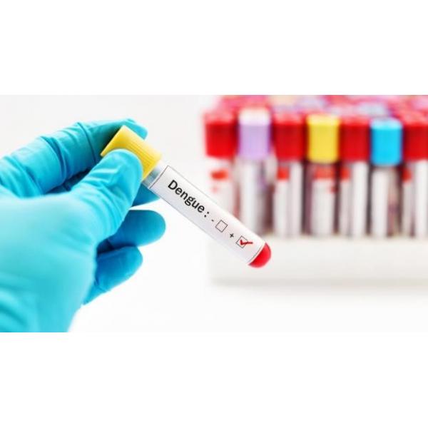 Quality CE Approved Dengue Ns1 Antigen Test Kit Antibody Rapid Test Cassette for sale