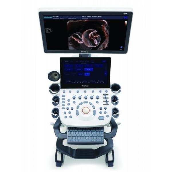Quality 21.5'' LED Sonoscape P10 Trolley Color Doppler Ultrasound Machine for sale