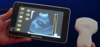 China USB Ultrasound Probe Digital Portable Ultrasound Scanner With Probe of Frequency 2~15MHz factory