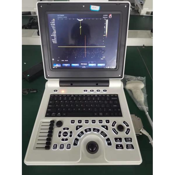 Quality USG OB GYN Portable USG Machine IMT Automatic Measurement for sale
