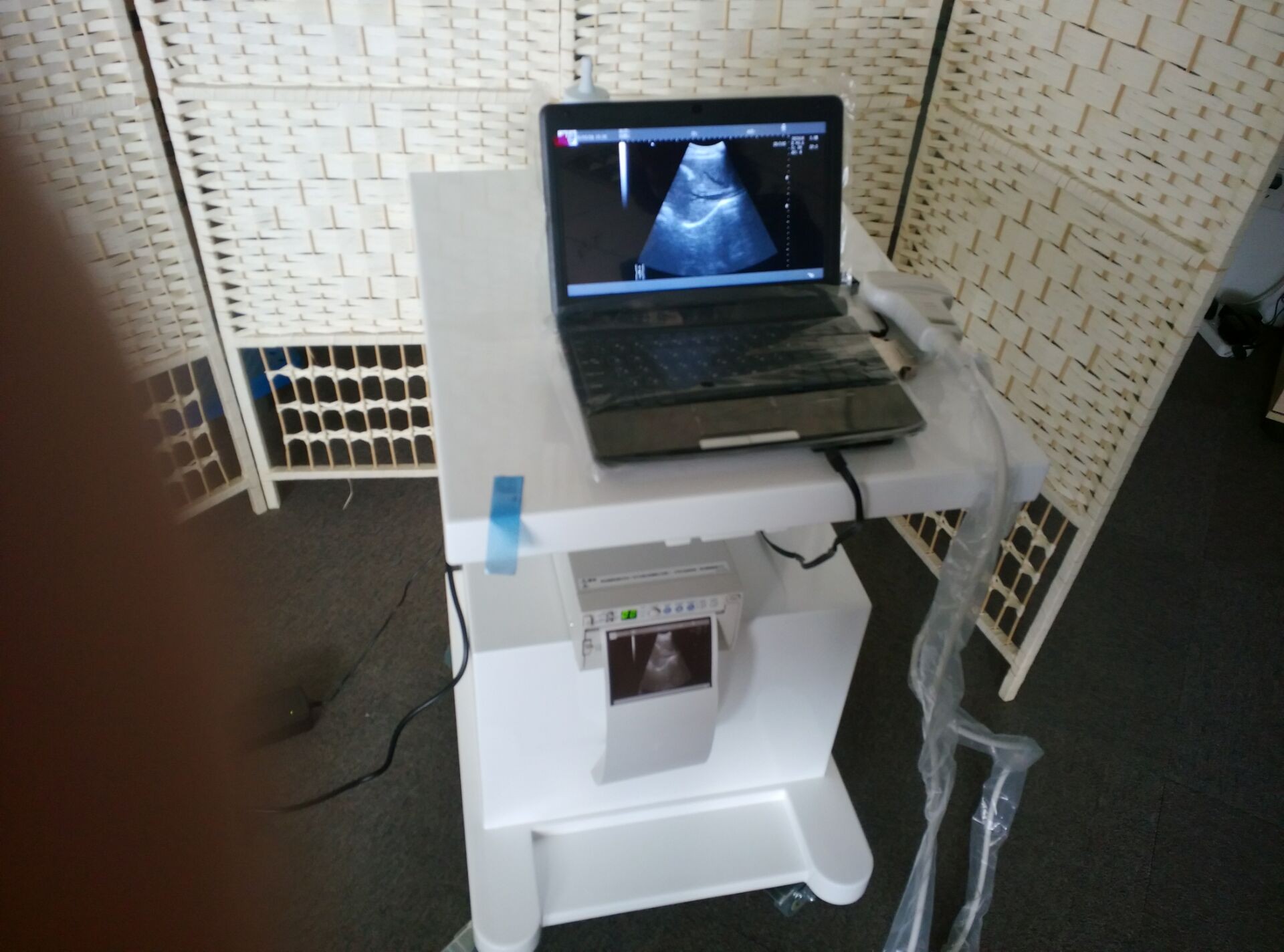 China Portable Baby Ultrasound Machine Portable Ultrasound Scanner for Pediatrics factory