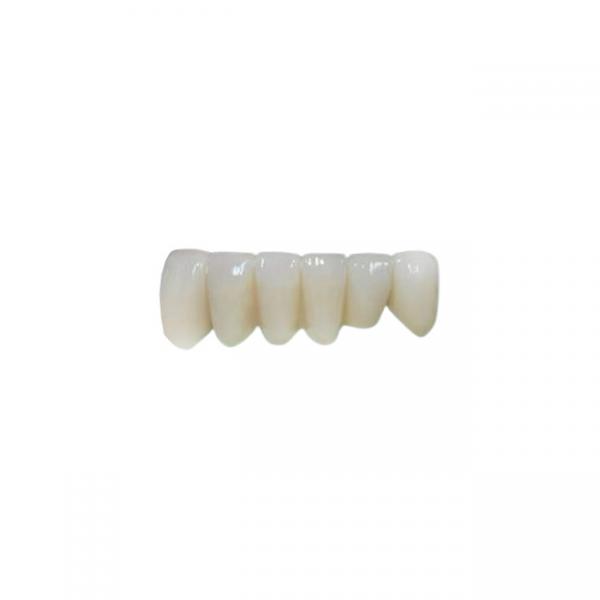 Quality OEM Implant Zirconia Dental Crown Fixed Bridge for sale