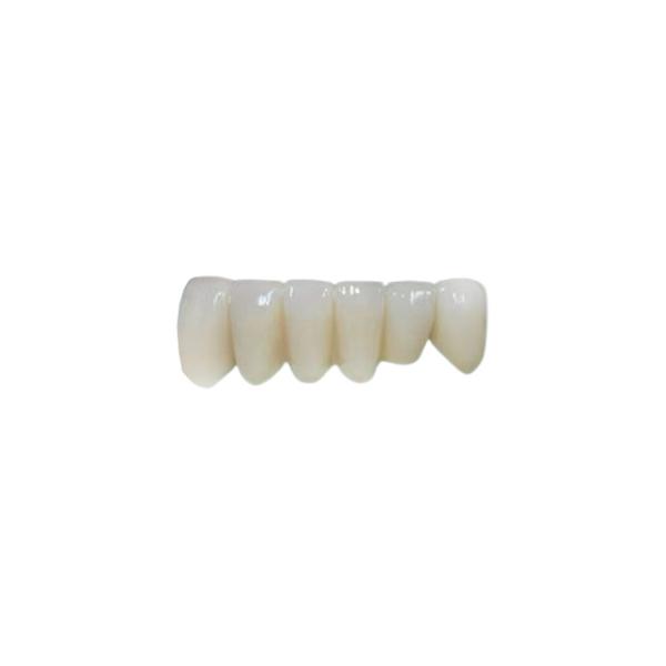 Quality OEM Implant Zirconia Dental Crown Fixed Bridge for sale