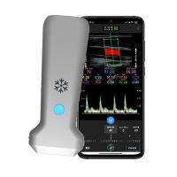 Quality WiFi 12.6cm Remote Portable Doppler Ultrasound Machine 30 Fps for sale