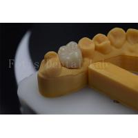 China Titanium / PFM Denture Crown Customizable Zirconia Implant Crown Durable factory