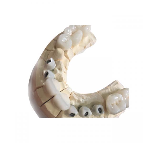 Quality Metal Free White Zirconia Dental Crowns Excellent Biocompatibility for sale