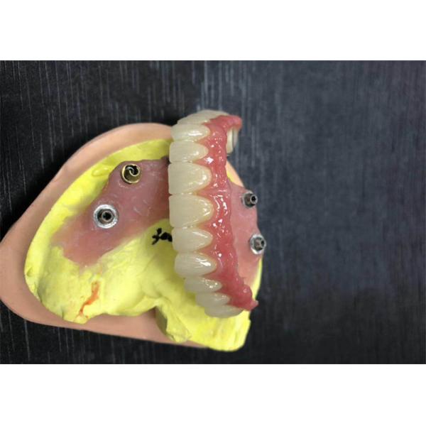 Quality Implant Abutment Zirconia Dental Crown Natural All On Four Dentures for sale