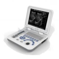 China OEM ODM Portable Ultrasound Machines For Home Use factory