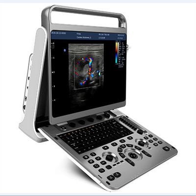 Quality Ergonomic Design Portable Ultrasound Machine Chison EBit 30 for sale