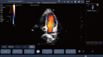 Transvaginal Ultrasound Probe Wireless Ultrasound Probe Color Portable Ultrasonic Diagnostic Devices