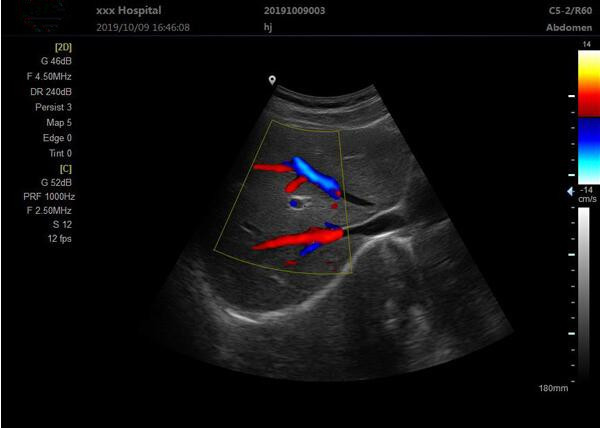 Quality Medical Ultrasound Machine Portable Ultrasound Scanner 4d Ultrasound Equipment for sale