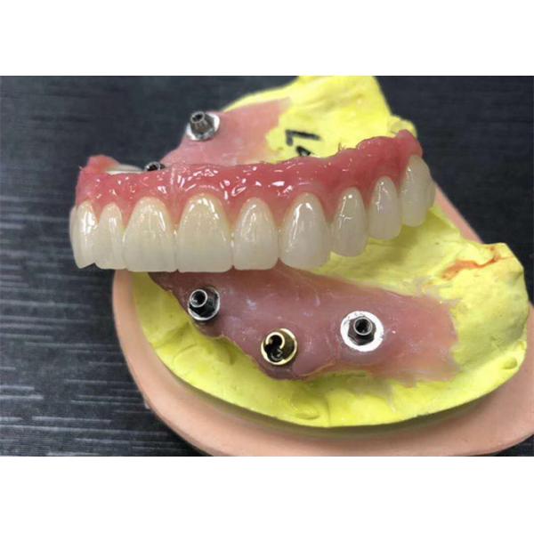 Quality Implant Abutment Zirconia Dental Crown Natural All On Four Dentures for sale