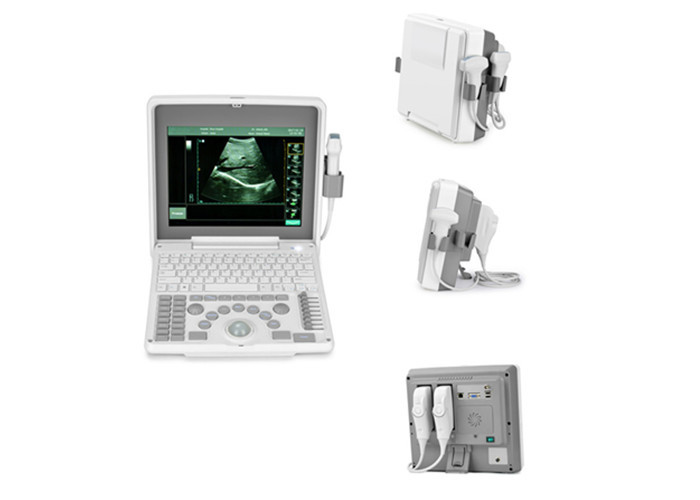 China Notebook Laptop Ultrasound Scanner Bio 3000J 12 Inch Screen Portable Ultrasound factory