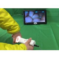China X 1.5 Magnification Digital Electronic Colposcope connect to TV or Computer or factory