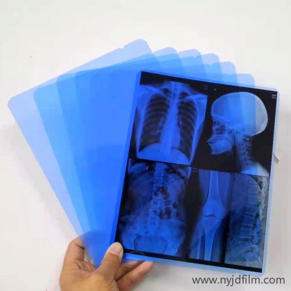 Quality 13x17 Inch Waterproof Laser Blue X Ray Film For Hospital Radiology Department for sale
