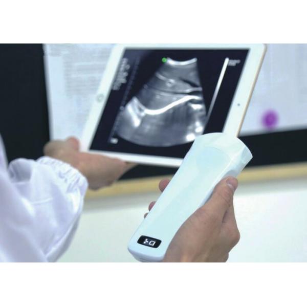Quality Wireless Ultrasound Probes Handheld Ultrasound Device With B, B/M, Color Doppler for sale