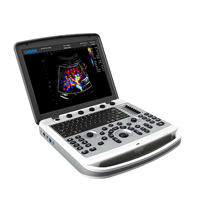 Quality 120° Rotatable Chison SonoBook 6 Portable Laptop Ultrasound Machine for sale